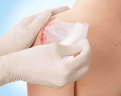 Cuticell Contact - Leukoplast 5cm x 7,5cm -5st